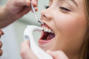 Dental Implants | Mountainside Dental Care | Oro Valley AZ