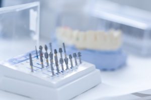 Dentures | Mountainside Dental Care | Oro Valley AZ